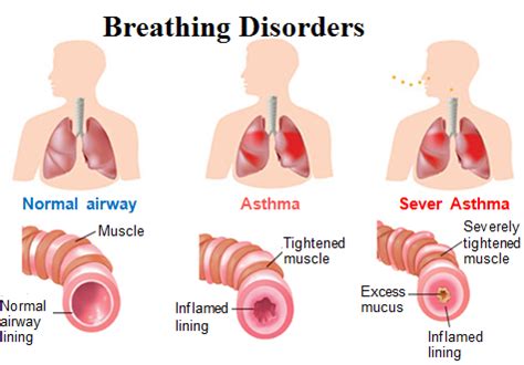 Abnormal Breathing and Breathing Disorders: – Karuna Yoga Vidya Peetham ...