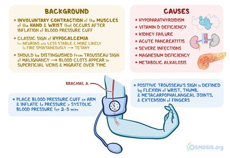 Trousseau Sign: What Is It, Causes, and More | Osmosis