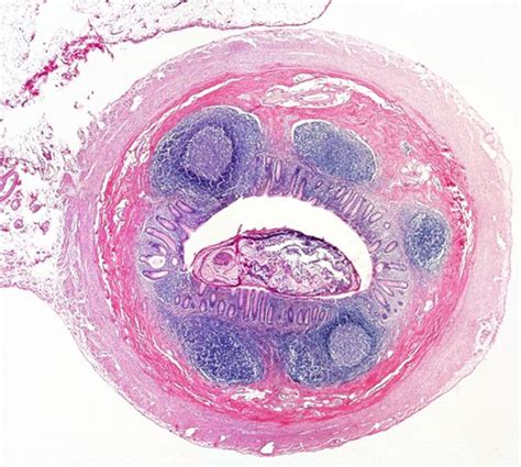 Appendix histology - mucosa associated lymphoid tissues (MALTs) | Histology slides, Medical art ...