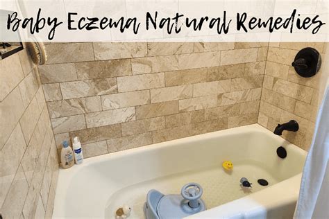 12 Baby Eczema Natural Remedies To Try | Bump To Busy Mama