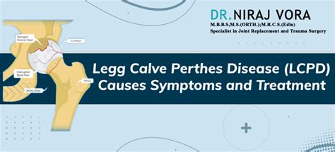 Treatment for Legg-Calve-Perthes Disease Mumbai