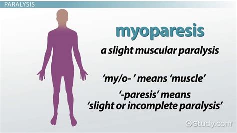 Terminology of Paralysis & Spinal Cord Injuries - Lesson | Study.com