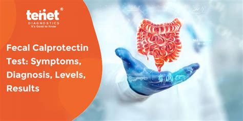 Fecal Calprotectin Test: Symptoms, Diagnosis, Levels, Results