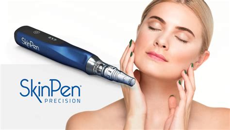 SkinPen in Dallas, Texas | Skin Specialists