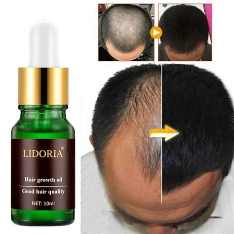 100% LIDORIA NATURAL HAIR GROWTH SOLUTION