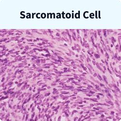 Mesothelioma Cells: The Three Major Mesothelioma Cell Types