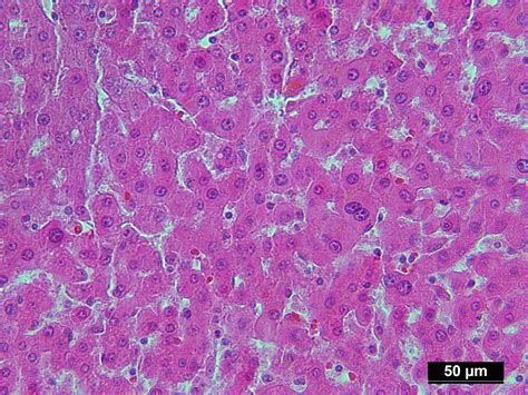 Human Liver Tissue (Normal) FFPE Sections