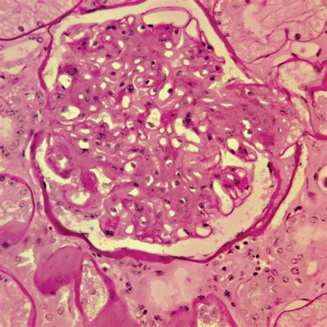 Periodic Acid Schiff's (PAS) Stain | Polysciences, Inc.