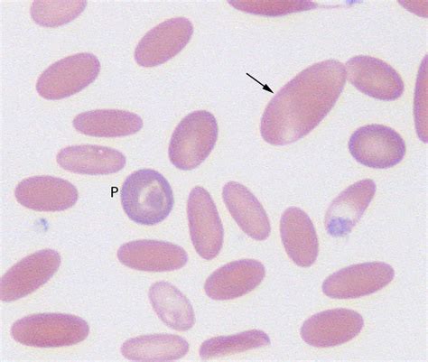 Regenerative anemia in camelid – eClinpath