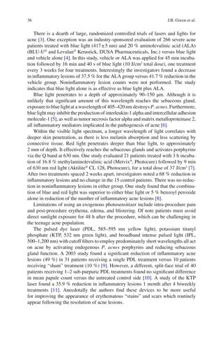 Acneiform Eruptions in Dermatology_ A Differential Diagnosis. 2014.pdf