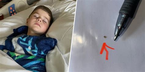 Powassan Virus Symptoms From Mom Of Boy Infected by Tick Bite