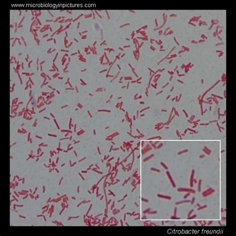 Citrobacter Freundii On Tsa Plate