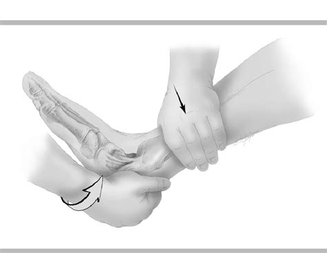 Anterior drawer test to assess the integrity of the anterior fibular... | Download Scientific ...