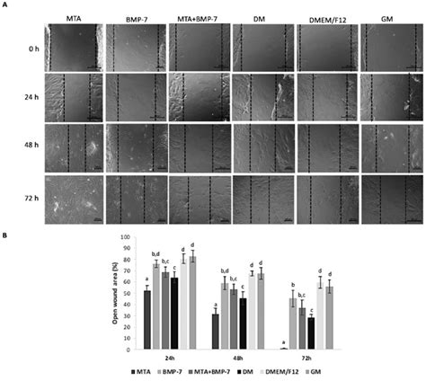 Wound healing assay results. A) Phase-contrast microscope images... | Download Scientific Diagram