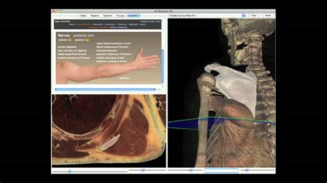 Cadaver Anatomy