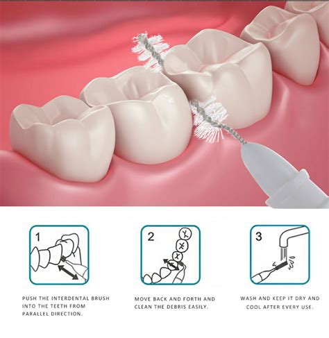 Why Use Interdental Brushes – Britten Perio