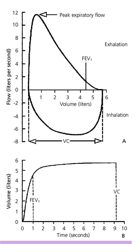 Normal spirometric flow diagram. (A) Flow-volume curve. (B) Volume-time ...