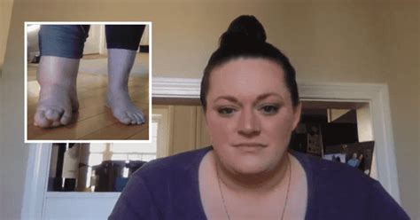 'My Feet Are Killing Me': 5 shocking cases that will make you want to ...