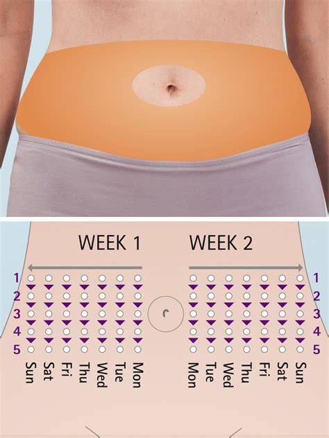 Insulin Injection Sites Chart