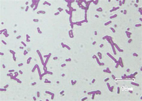 Gambar 1. Lactobacillus sp. setelah dilakukan pewarnaan gram. Warna ...