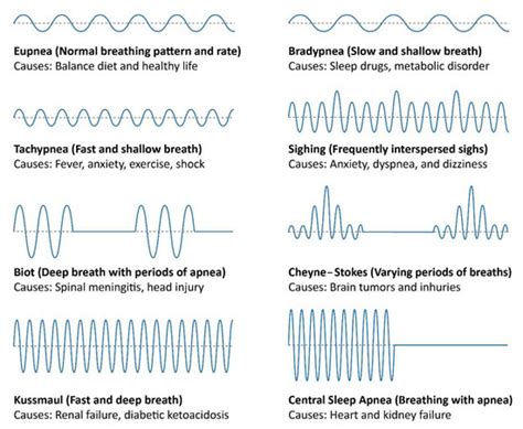 Sensors | Free Full-Text | Improving Machine Learning Classification ...