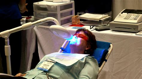 laser-teeth-whitening - All Smiles Dent Spa