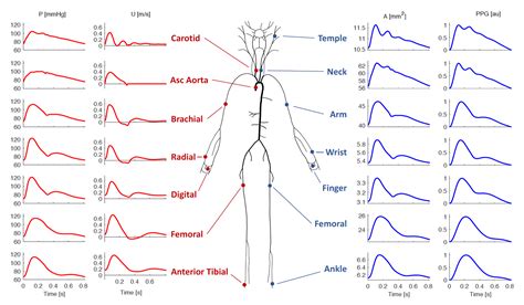 Simulated Pulse Wave Database by peterhcharlton