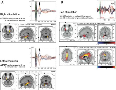 Fornix/hypothalmic stimulation leads to localized changes in the ...