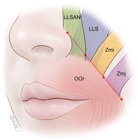 Heights and spatial relationships of the facial muscles acting on the ...