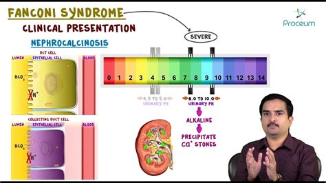 Fanconi Anemia Diagnosis