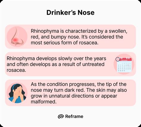 Alcoholic Nose: What It Is and How To Cope