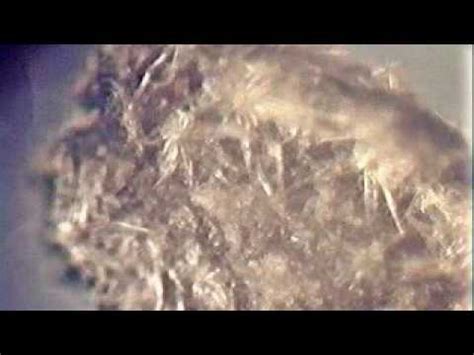 Morgellons, mites? spiders? fungus? - YouTube