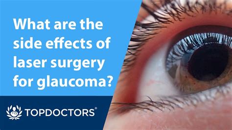 What are the side effects of laser surgery for glaucoma? - YouTube