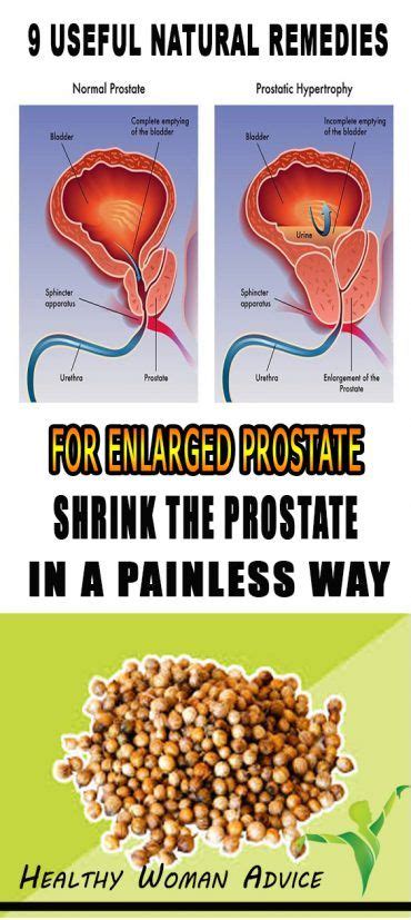 9 USEFUL NATURAL REMEDIES FOR ENLARGED PROSTATE SHRINK THE PROSTATE IN ...