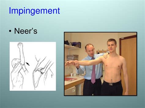 Shoulder Impingement Test