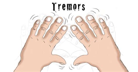 Tremor Diagnosis and Tremor Treatment Archives - Natural Health News