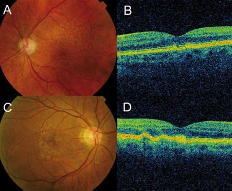 Zeiss OCT - Roswell Eye Clinic