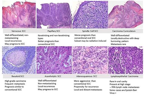 Dermatología en cuadro Edición 441 – PIEL-L Latinoamericana