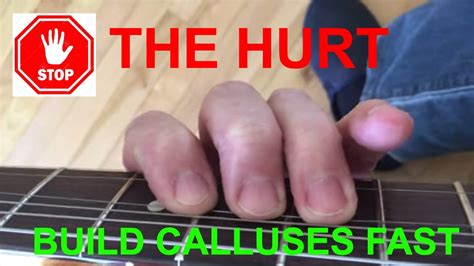 How To Build Calluses Guitar - Constructiongrab Moonlightchai