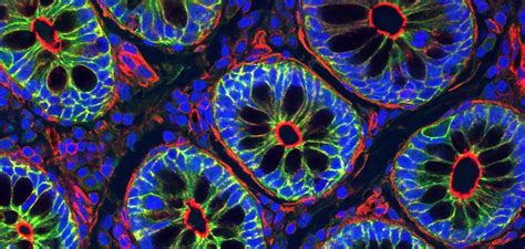 Cell polarity and membrane dynamics