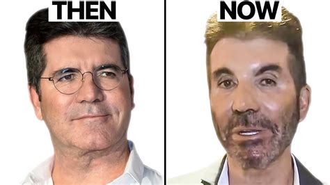 Simon Cowell NEW FACE | Plastic Surgery Analysis - YouTube