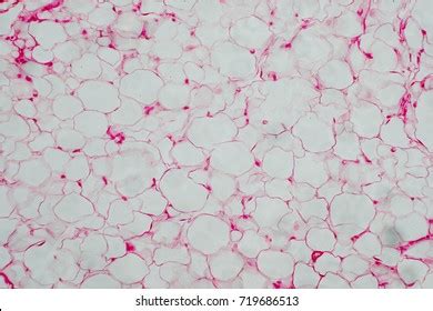 Humanbody Fat Cells Under Microscope View Stock Photo 719686513 | Shutterstock