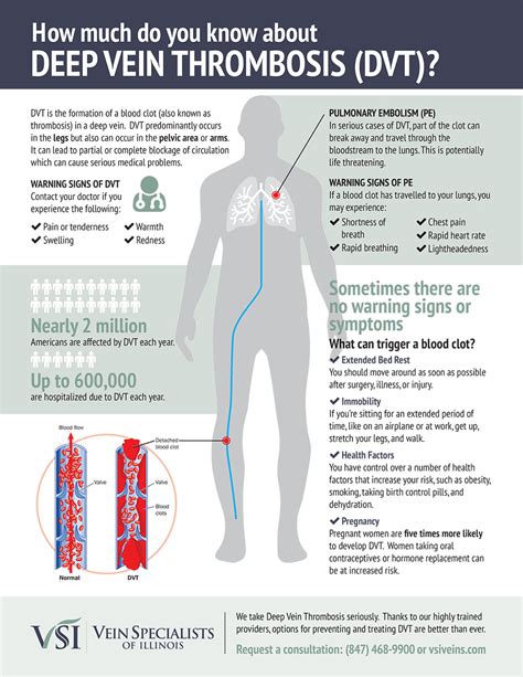 DVT Infographic - Vein Specialists of Illinois