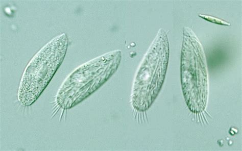 Unidentified Ciliophora