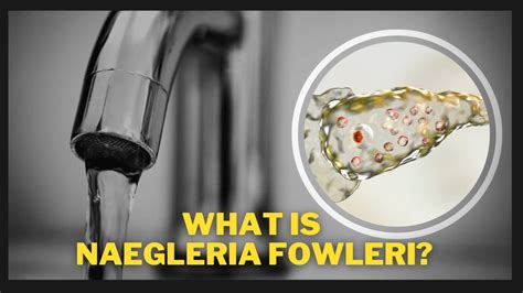 What Is Naegleria Fowleri? The Deadly Brain-Eating Amoeba Infection ...