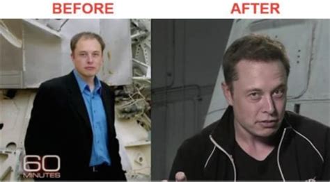 Elon Musk Hair Transplant: Bald to Hair (How He Did It) - Bald & Beards