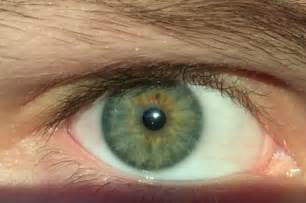 File:Human-eye-color-green.png - Wikimedia Commons