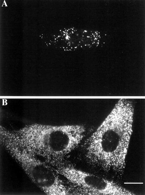 Overexpression of PEX11 induces peroxisome proliferation. 5756T cells ...