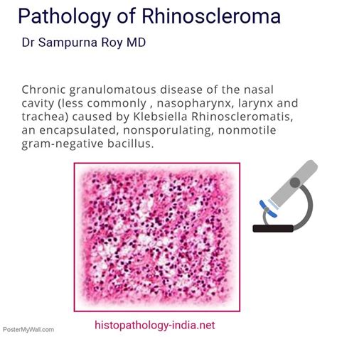 Pathology of #Rhinoscleroma - #Infectious #Disease | Chronic granulomatous disease, Nasal cavity ...