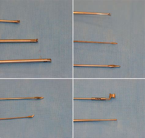 Laryngeal cleft. | Semantic Scholar